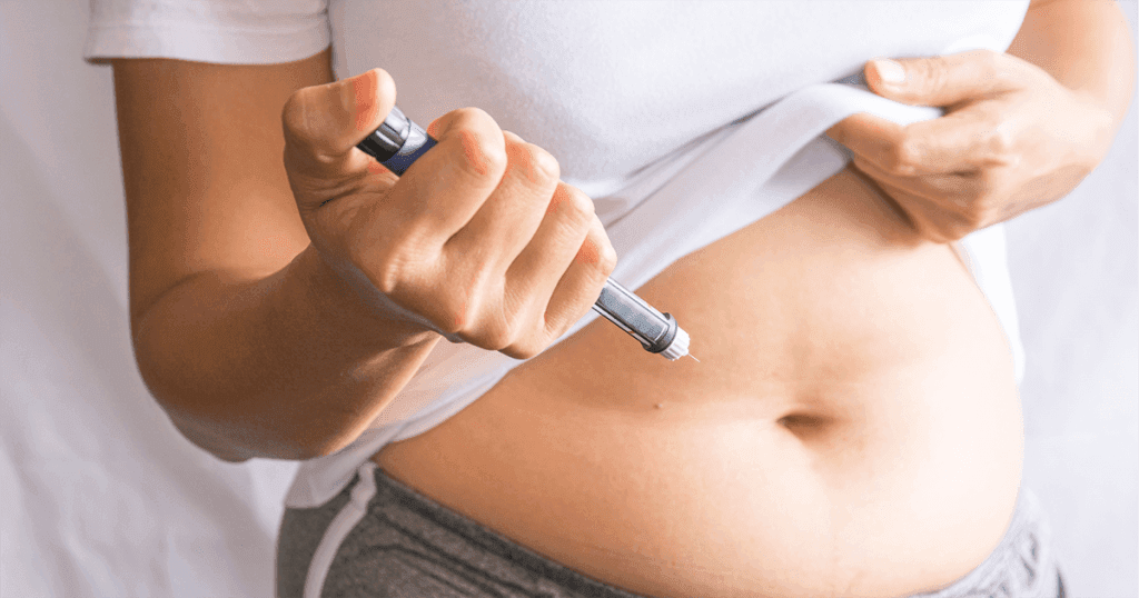 GLP-1 weight management therapy